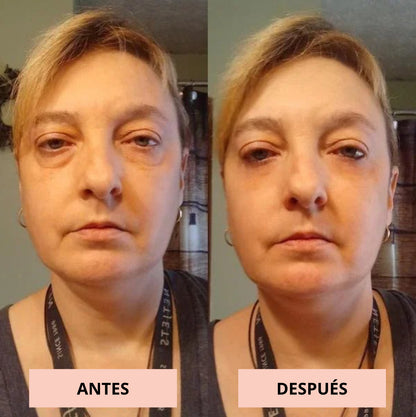 MicroGlow Patches Lift